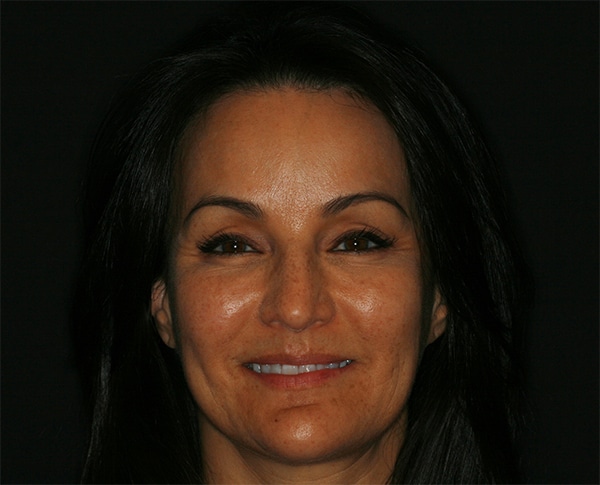 Konig Center for Cosmetic & Comprehensive Dentistry smile photos